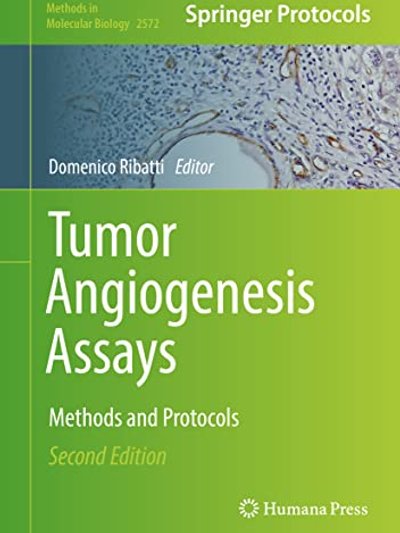 Tumor Angiogenesis Assays